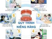 CÁC GIAI ĐOẠN CỦA CHỈNH NHA